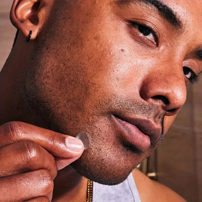 720 Count Hydrocolloid Acne Patches, Blemishes Pimples Covering Patch